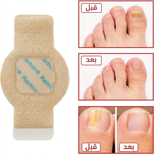 NailRestore™ – Patch Réparateur Intensif pour Ongles Abîmés (21 Patchs) — vue 2