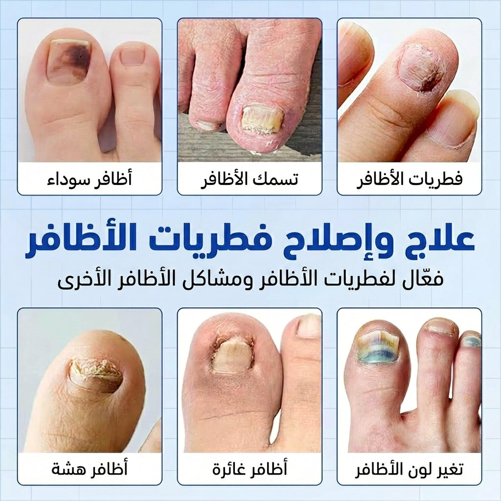 NailRestore™ – Patch Réparateur Intensif pour Ongles Abîmés (21 Patchs) — vue 6